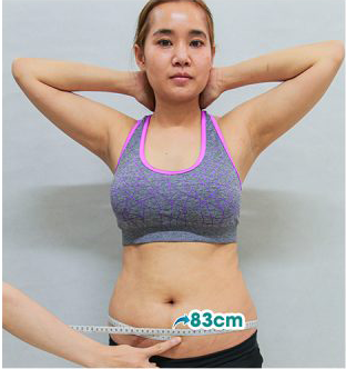 Trước khi hút mỡ - Body Contouring